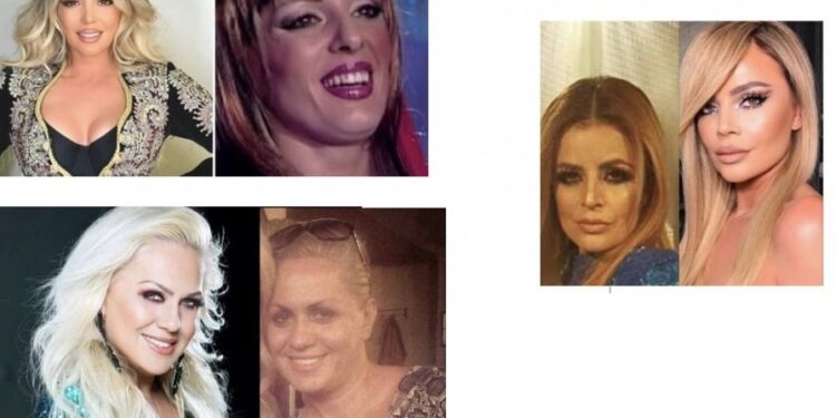 Këngëtaret kosovare kanë zbuluar ‘pilulën’ që po i rinon nga 50 në 20 vjeç