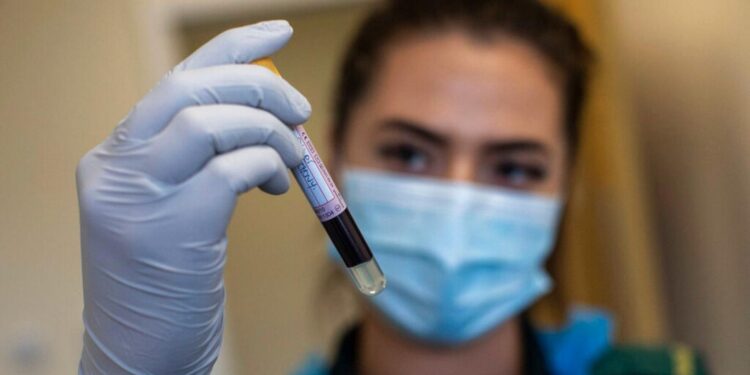 Studimet: Organet që dëmton koronavirusi te personat që e kalojnë pa simptoma