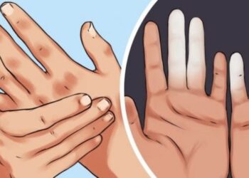 Çfarë tregojnë mpirja e duarve dhe marramendjet për shëndetin tuaj?