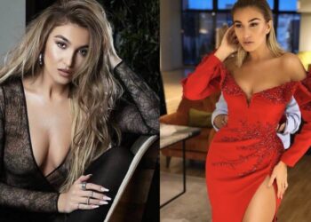 Tash duket e bukur, por ja si dukej para shumë operacioneve plastike Yllka Kuqi!