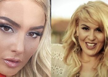 A mendoni që Jehona ka ndërhyrje estetike apo bën photoshop?