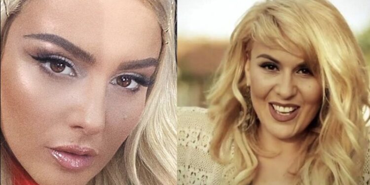 A mendoni që Jehona ka ndërhyrje estetike apo bën photoshop?