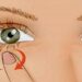 A keni pësuar ndonjëherë dridhje të njërit sy? Ja pse ndodh kjo gjë