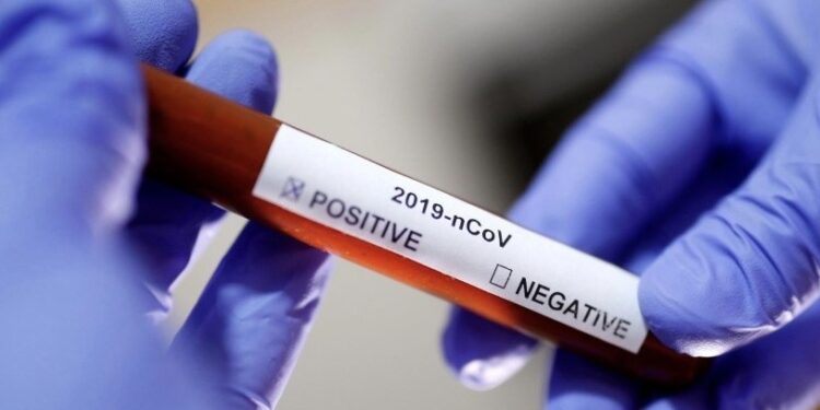 Reperi i njohur kosovar infektohet me koronavirus