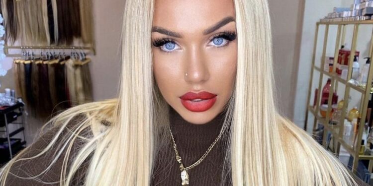 Adelina Tahiri para dhe pas operacioneve në fytyrë