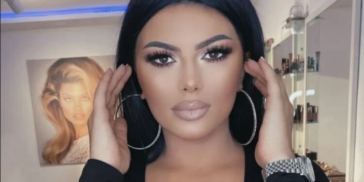 Ja si duket Kallashi me buzë të fryra