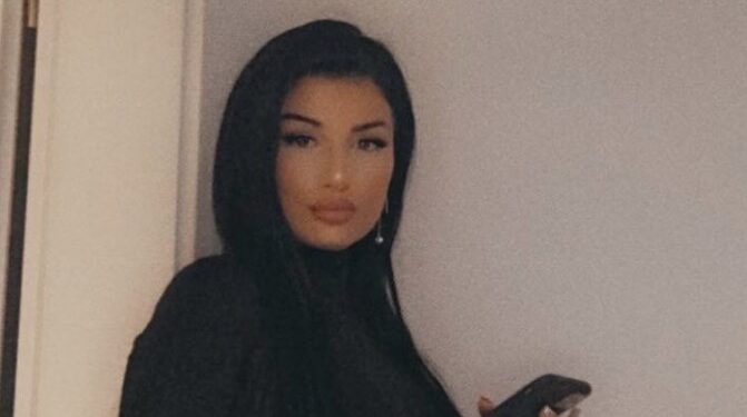 Kështu i fryn buzët gruaja e Goldit