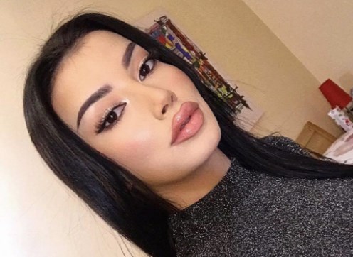 Të dashurës së Shpat Kasapit gati i shpërthejnë buzët nga botoxi