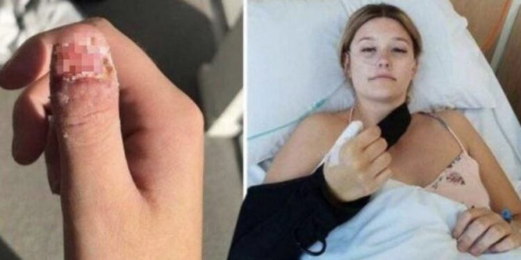 Historia e kësaj vajzeje është arsyeja përse nuk duhet t’i hani thonjtë