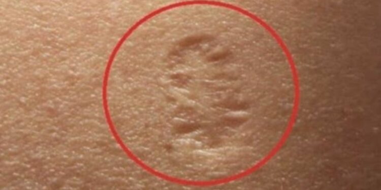 A e dini domethënien e kësaj shenje në krahë