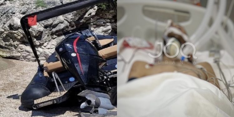 Mjekët nuk i japin shpresa jete të riut që u përplas nga gomonia, ka nevojë urgjente për gjak