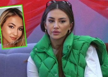 Nuk do besoni si dukej Kiara Tito para ‘ndërhyrjeve’ në fytyrë (Foto)