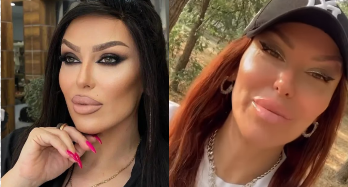 Ҫfarë ka ndodhur me fytyrën e Arta Bajramit / Këngëtarja habit fansat