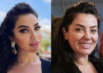 ‘Xhbanja’ larg Instagramit, krejt ndryshe në realitet