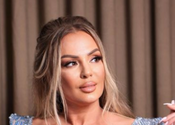 Violeta e ka tepruar me operacione plastike në fytyrë, mezi po i mbanë sytë hapur nga ndërhyrjet