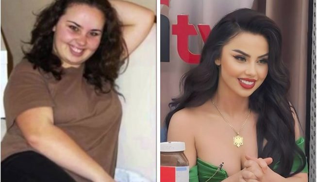 Për ju që e keni harruar, kjo ishte Lindita Halimi para operacioneve plastike