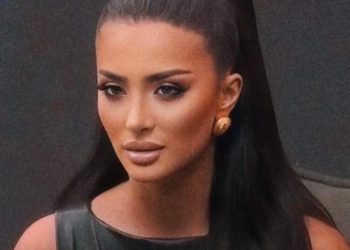 Ja si dukej Alba përpara operacioneve plastike (Foto)