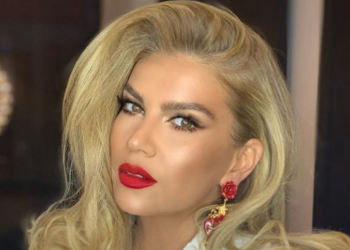 Leonora e ka mbushur fytyrën me botoks, por ka harruar se rrudhat i vërehen në pjesë të tjera të trupit