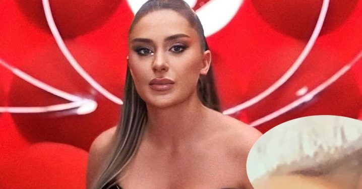 Vesa Smolices i del zogu live në prime