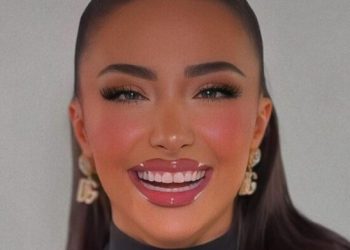 Menjëherë pasi doli nga BBVK, Alba i kthehet dashurisë së vjetër