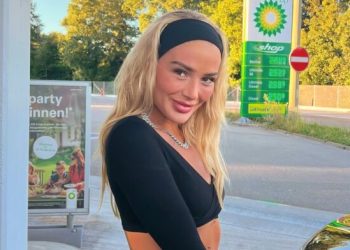 Në këtë foto pa filtra, Loredana dëshpëron me pamjen