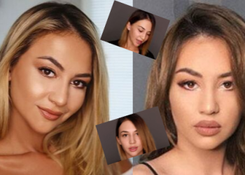 Sa ndërhyrje në fytyrë ka Kiara Tito?