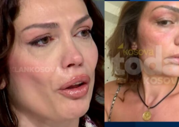 Publikohen fotot: Kështu u rrah ish-miss Kosova nga burri i saj