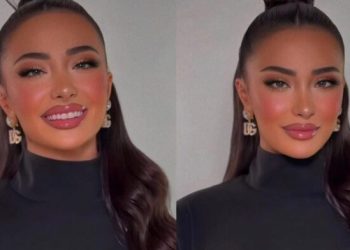 Alba shfaqet me ‘shenja’ në trup / ꞔfarë po ndodh me ish banoren e BBVK?