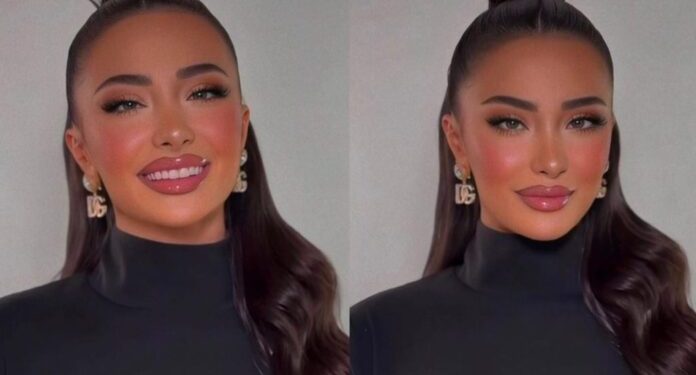 Alba shfaqet me ‘shenja’ në trup / ꞔfarë po ndodh me ish banoren e BBVK?