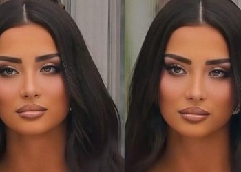 Ja si dukej Alba vite më parë si bionde