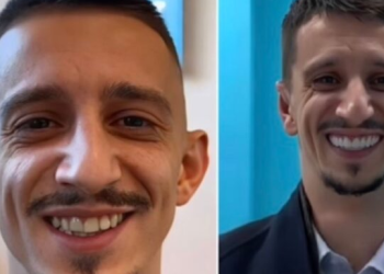 Gani Germia publikon foto pas ndërhyrjeve në fytyrë, nuk do ta njihni