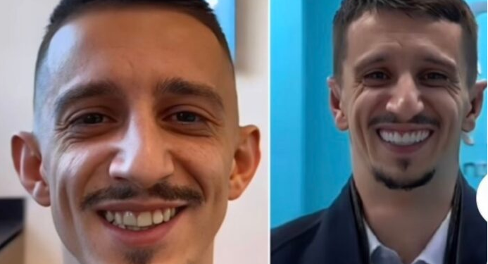 Gani Germia publikon foto pas ndërhyrjeve në fytyrë, nuk do ta njihni