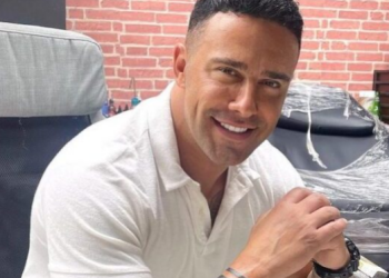 Robert Berisha ka bërë botox në fytyrë, e pranon edhe ndërhyrjen tjetër