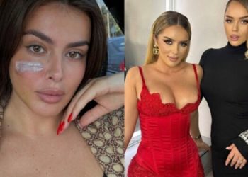 Zbulohet ekspertiza e bërë mbi Klea Prengën, dëme të përhershme e të parikuperueshme?