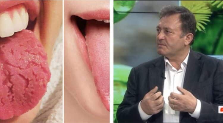 Ylli Merja : Shikoni ngjyrën e gjuhës tuaj dhe kuptoni se nga çfarë problemesh shëndetësore vuani