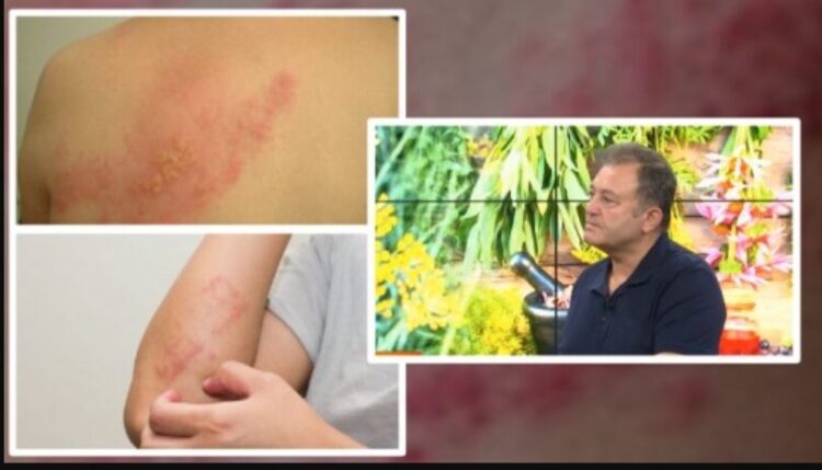 ‘Zjarri i Natës’, si ta kuptojmë dhe parandalojmë sëmundjen torturuese përpara se të jetë tepër vonë. Metodat natyrale të trajtimit sipas Ylli Merjas