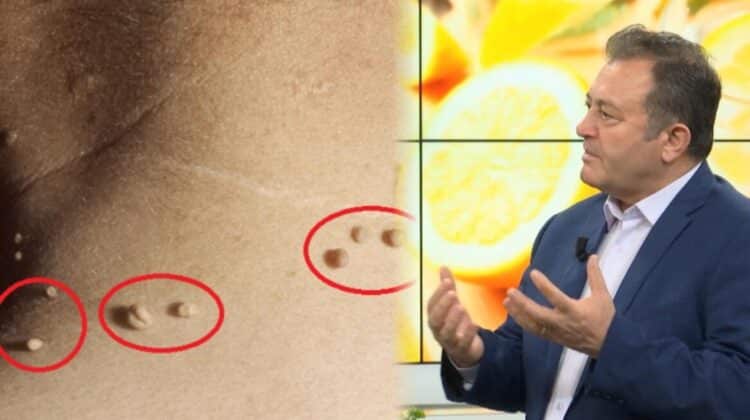 Lythat, kërcënim i heshtur i trupit! Specialisti i bimëve mjekësore Ylli Merja prezanton bimën që i zhduk plotësisht ato me…