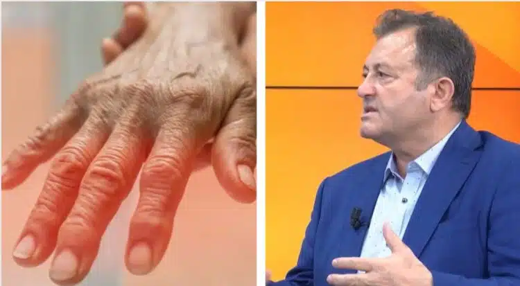 Ylli Merja: Mënyrat për të kuruar artritin brenda një jave me…