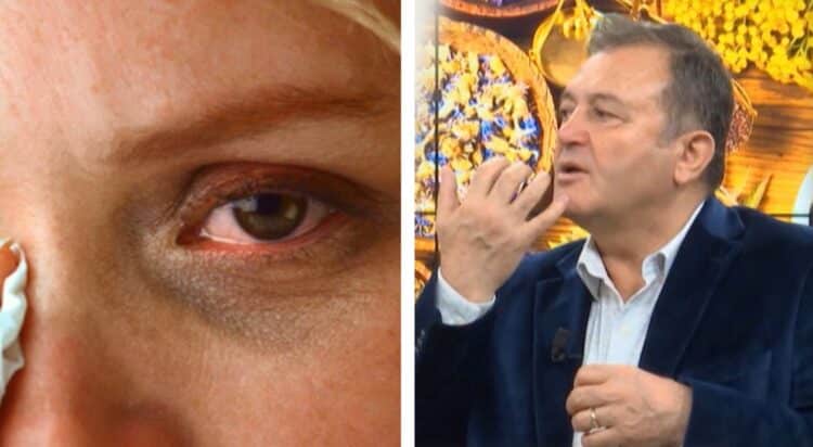 Ylli Merja: Si të kuroni infeksionet e syve me çajin bimor: Përgatitja e çajit bëhet me…