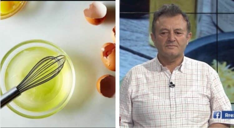 Ylli Merja: E bardha e vezës dhe glikoja e arrës, zgjidhje për të kuruar gastritin: Gastriti dhe ulcera janë sëmundje që mund të kalohen me…