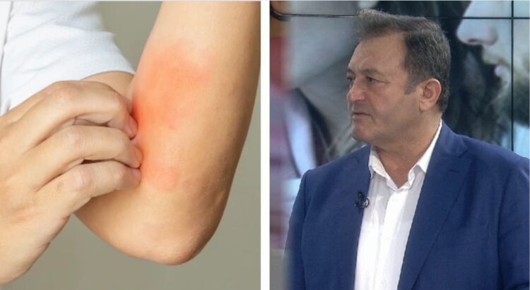 Ylli Merja: Vuani nga anemia, ja si ta trajtoni me kete bime: Kjo bimë ka efekte çudibërëse edhe në trajtimin e…
