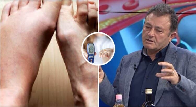 Këmba diabetike, kujdes! Këto janë sinjalet e para / Ylli Merja: Ja si të shëroni plagët e diabetit dhe te…